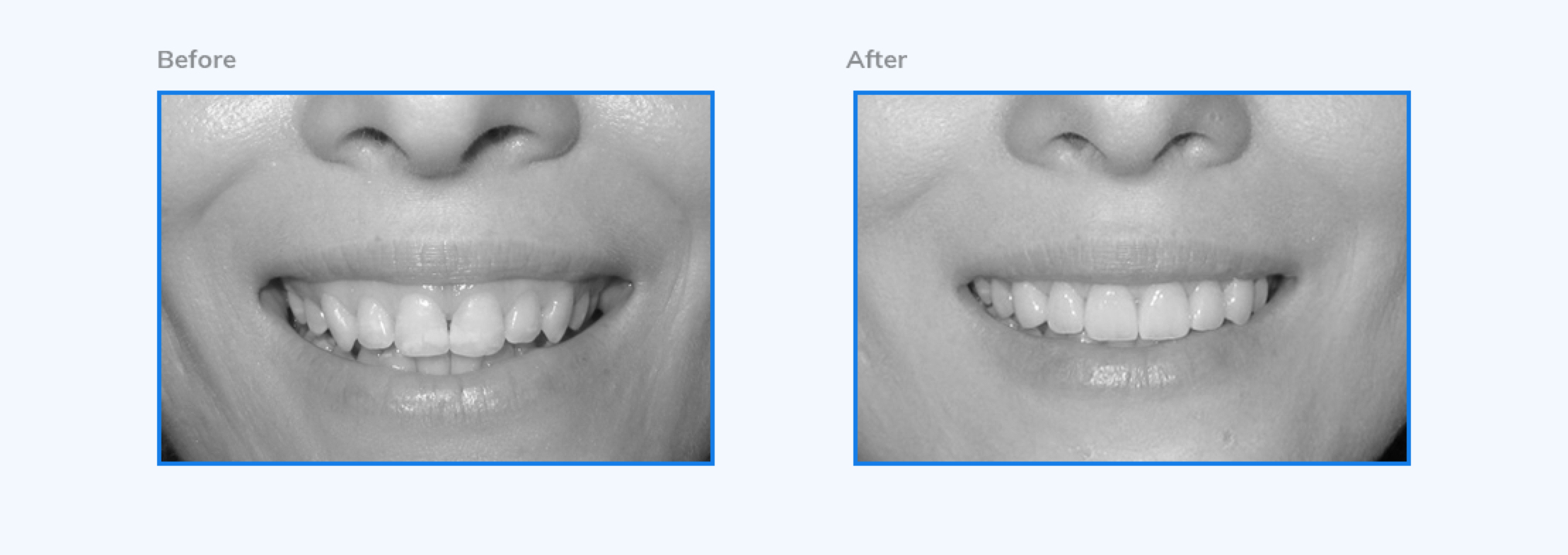 Galería dental - Ortodoncia y sonrisas